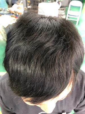 After image
