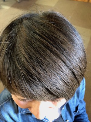 After image