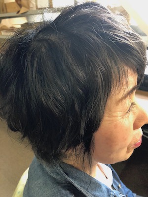 Before image