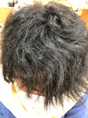 Before image