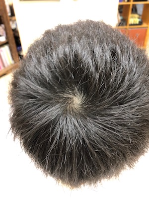 After image
