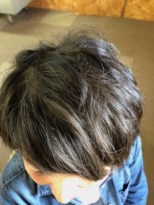 Before image