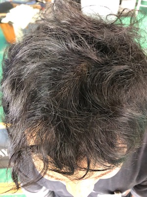 Before image